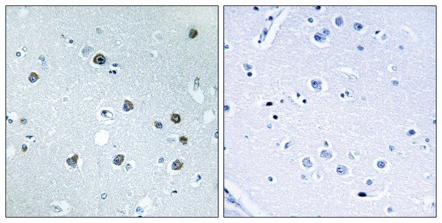 Anti-MYO1D antibody produced in rabbit