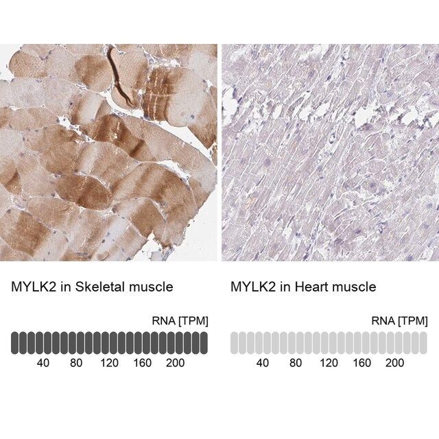 Anti-MYLK2 antibody produced in rabbit