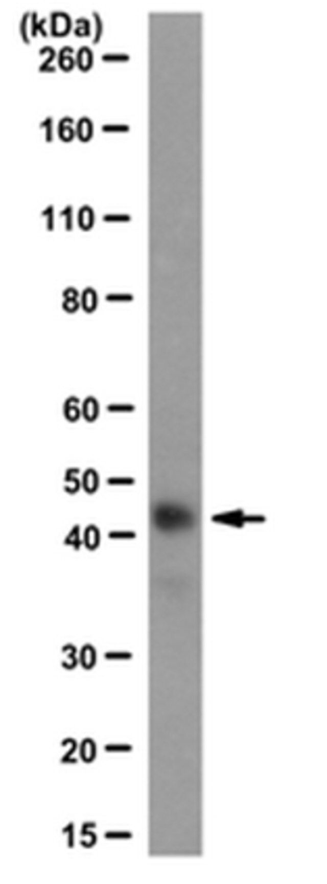 Anti-MyoD Antibody, clone 5F11