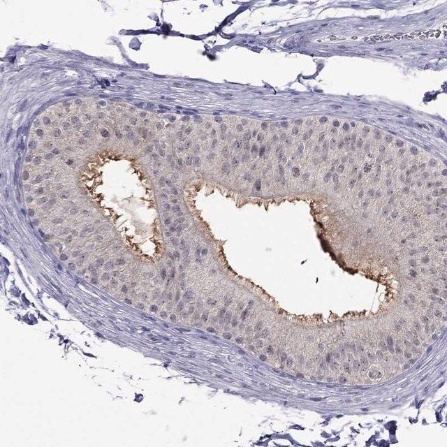 Anti-MYO3B antibody produced in rabbit