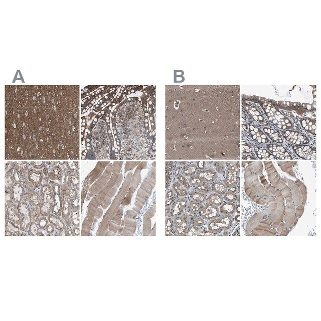 Anti-MYO18A antibody produced in rabbit