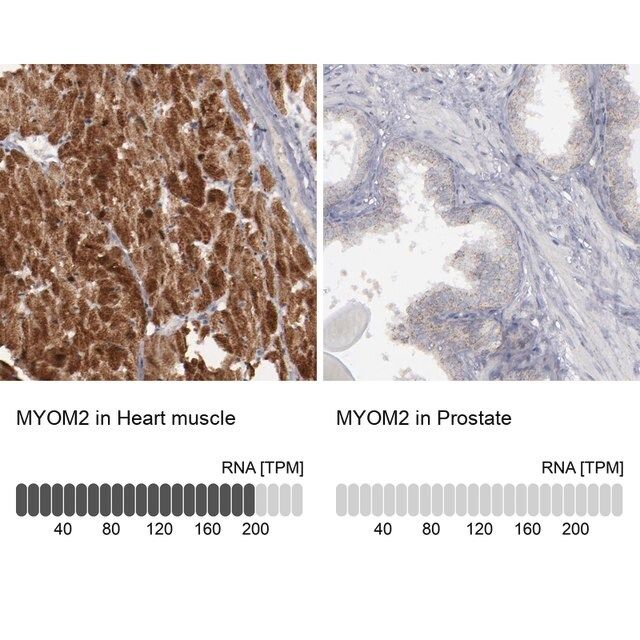 Anti-MYOM2 antibody produced in rabbit