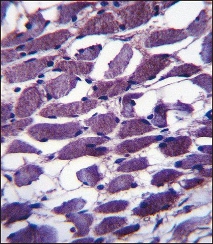 ANTI-MYOM1 (CENTER) antibody produced in rabbit