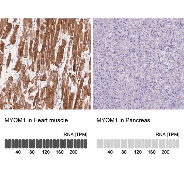 Anti-MYOM1 antibody produced in rabbit