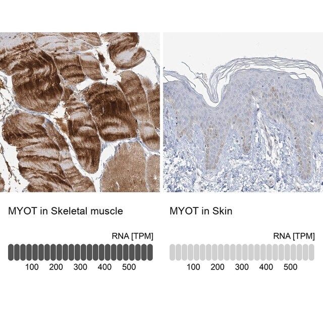 Anti-MYOT antibody produced in rabbit