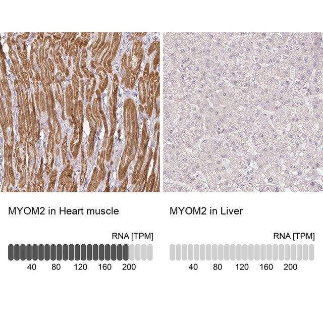 Anti-MYOM2 antibody produced in rabbit