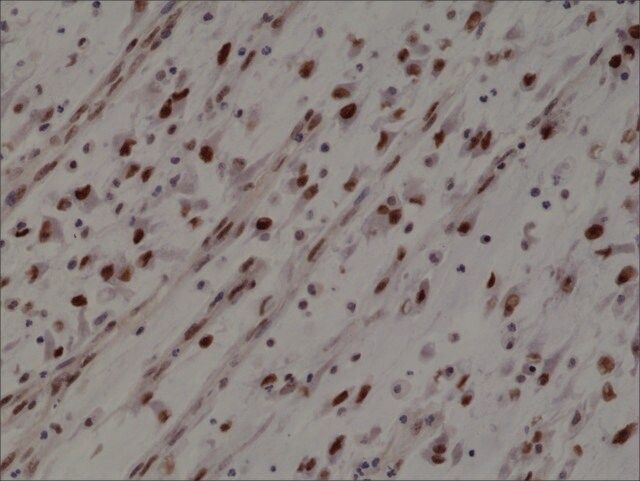 Anti-MyoD1 antibody, Rabbit monoclonal