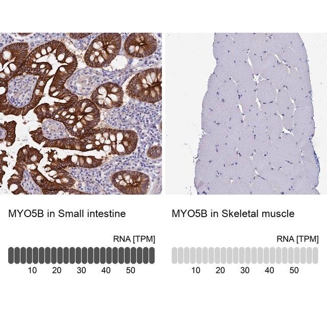 Anti-MYO5B antibody produced in rabbit