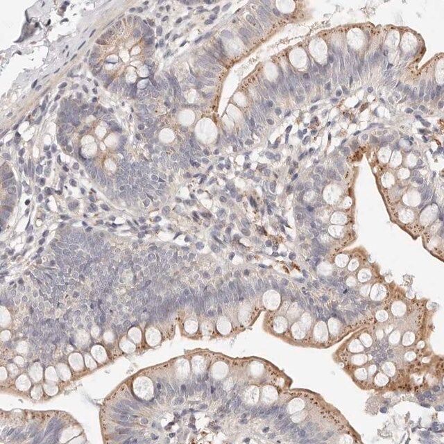 Anti-MYOM3 antibody produced in rabbit