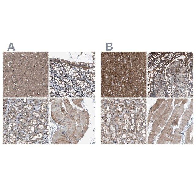 Anti-MYO18A antibody produced in rabbit