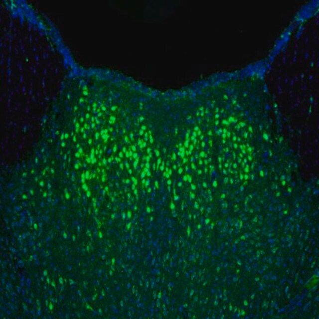 Anti-NAGLU antibody produced in rabbit