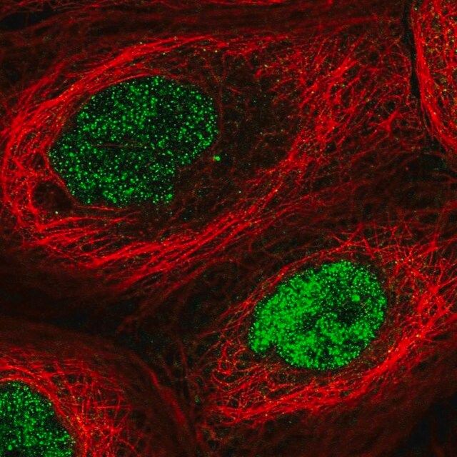 Anti-N6AMT1 antibody produced in rabbit