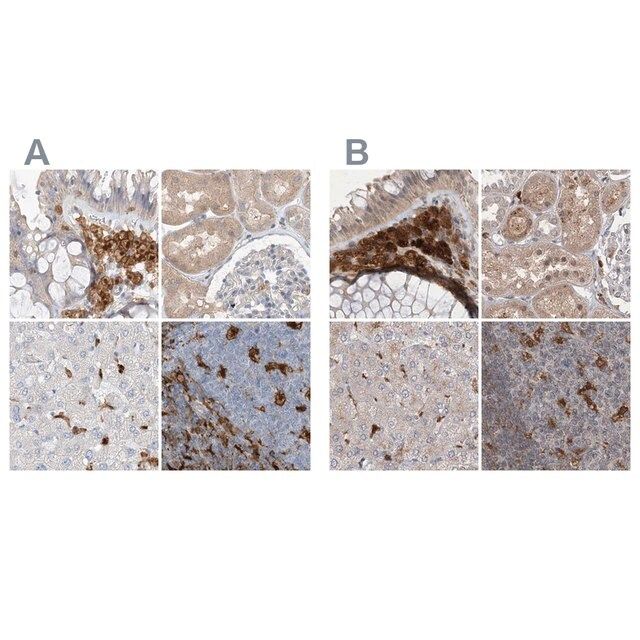 Anti-NAGK antibody produced in rabbit