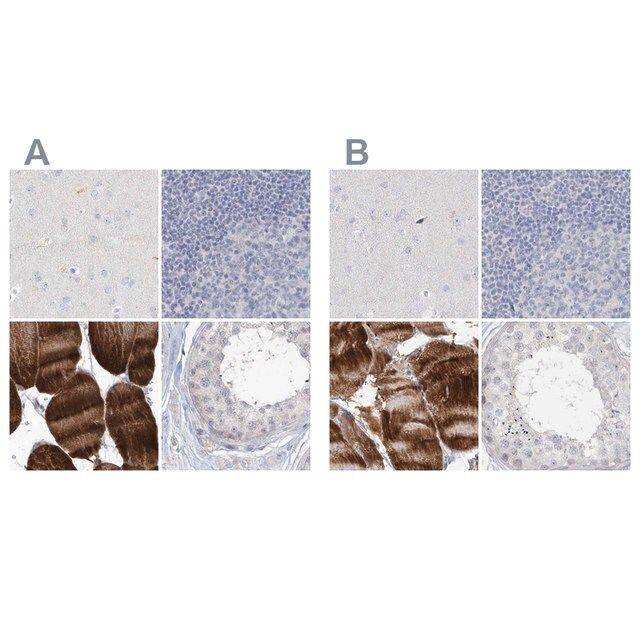 Anti-MYOT antibody produced in rabbit