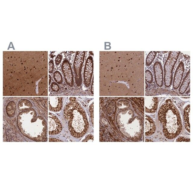 Anti-NAE1 antibody produced in rabbit