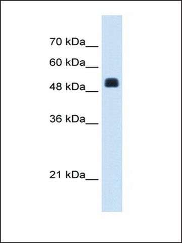 Anti-NAGS antibody produced in rabbit