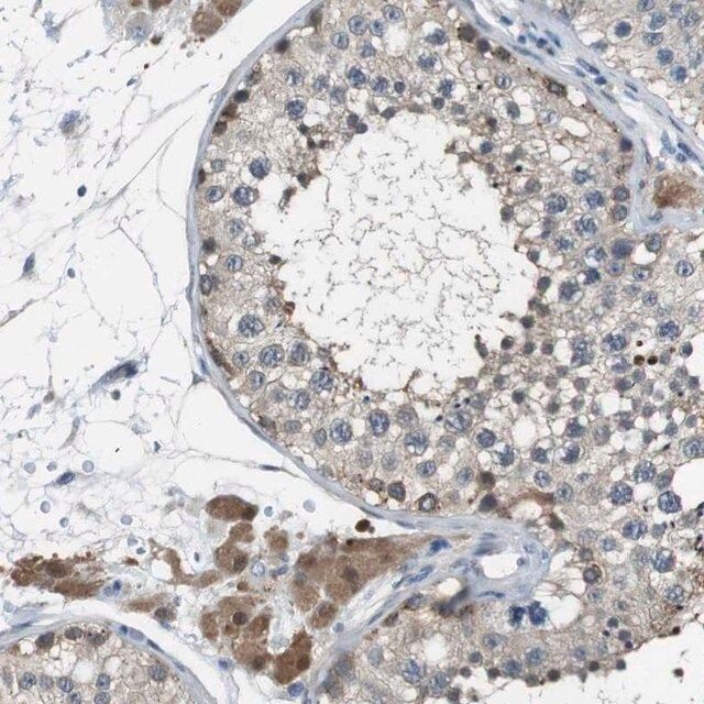 Anti-NANOS2 antibody produced in rabbit