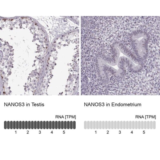 Anti-NANOS3 antibody produced in rabbit