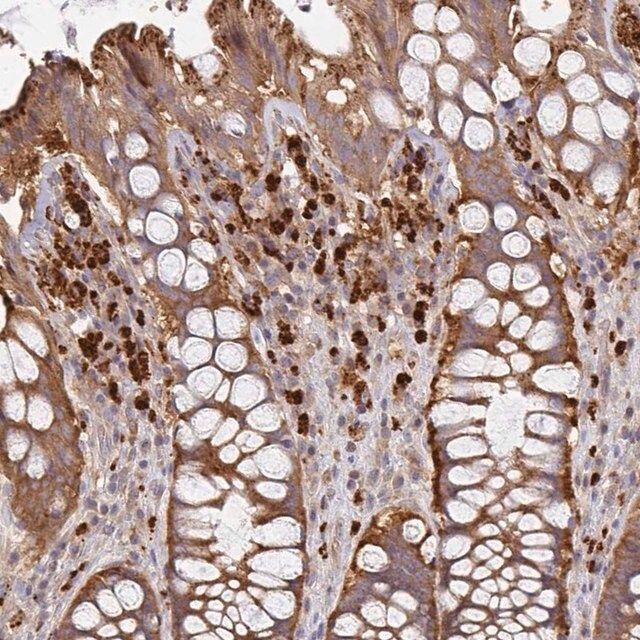 Anti-NADSYN1 antibody produced in rabbit