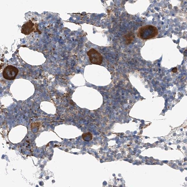 Anti-NALCN antibody produced in rabbit