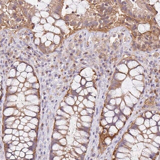 Anti-NADSYN1 antibody produced in rabbit