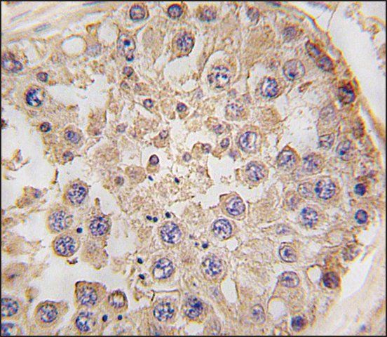 Anti-NANOS2 (C-term) antibody produced in rabbit