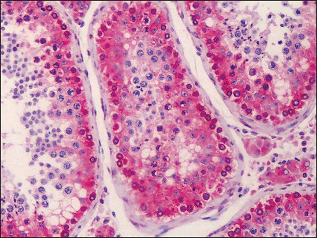 Anti-NANOS3 antibody produced in rabbit