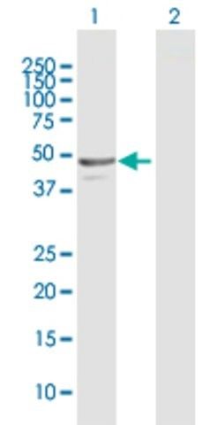 Anti-NAPRT1 antibody produced in rabbit