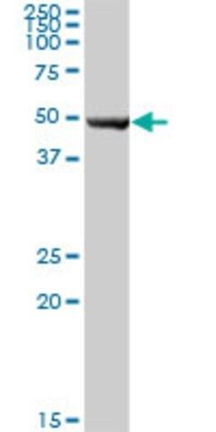 Anti-NAPRT1 antibody produced in mouse