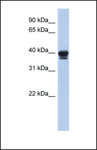 Anti-NAPE-PLD, (N-terminal) antibody produced in rabbit