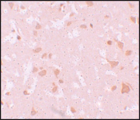 Anti-NALP7 antibody produced in rabbit