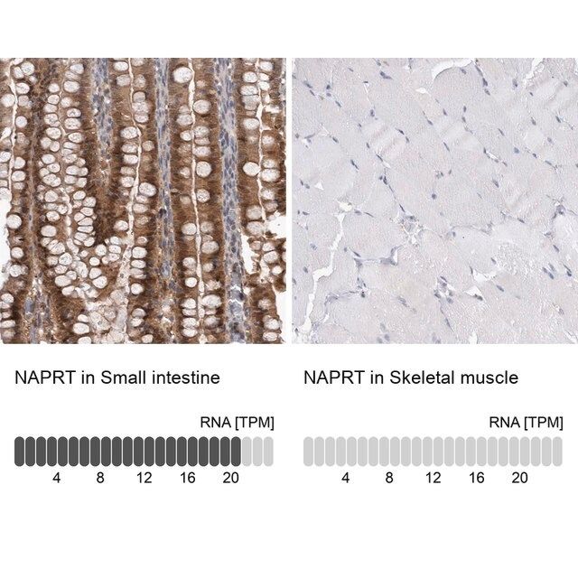 Anti-NAPRT antibody produced in rabbit