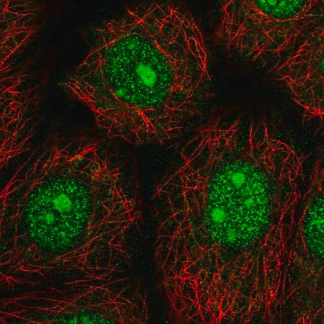 Anti-NARF antibody produced in rabbit