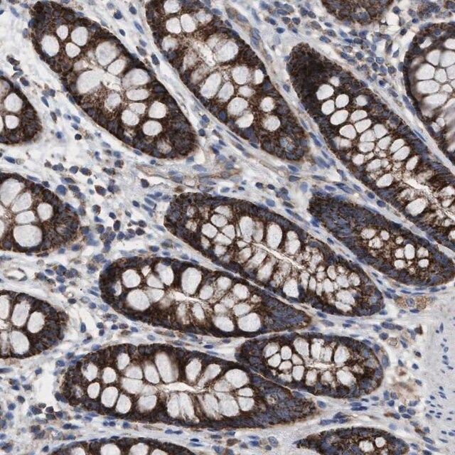 Anti-MRM1 antibody produced in rabbit