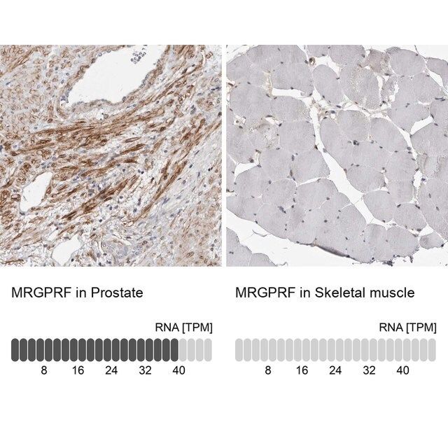 Anti-MRGPRF antibody produced in rabbit