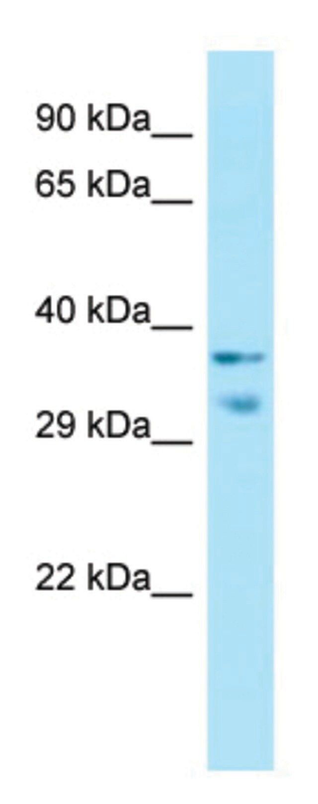 Anti-MRGPRX1 (C-terminal) antibody produced in rabbit