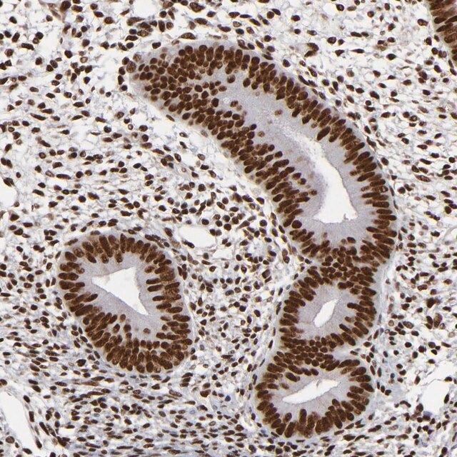 Anti-MRE11 antibody produced in rabbit