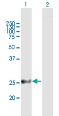 Anti-MREG antibody produced in mouse