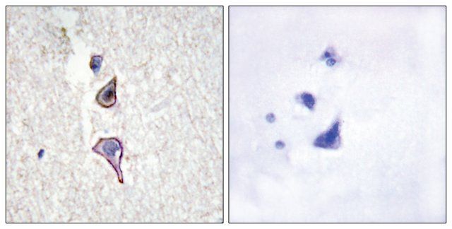 Anti-MRC2 antibody produced in rabbit