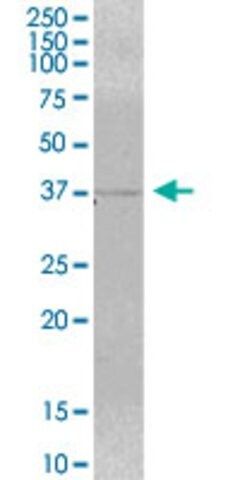 Anti-MRM1 antibody produced in mouse