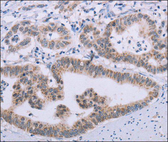 Anti-MRGPRX1 antibody produced in rabbit