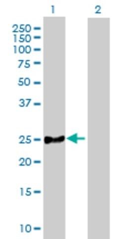 Anti-MRPL21 antibody produced in mouse