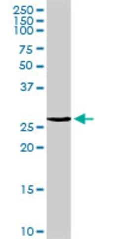 Anti-MREG antibody produced in rabbit