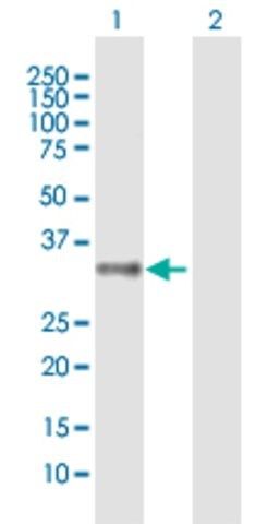 Anti-MRGPRX2 antibody produced in mouse