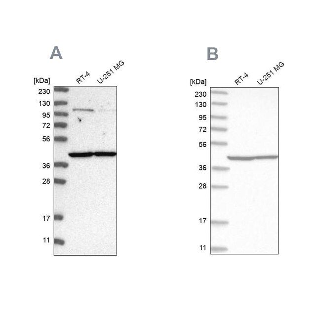 Anti-MRPL37 antibody produced in rabbit