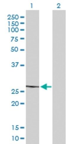 Anti-MRPL22 antibody produced in mouse