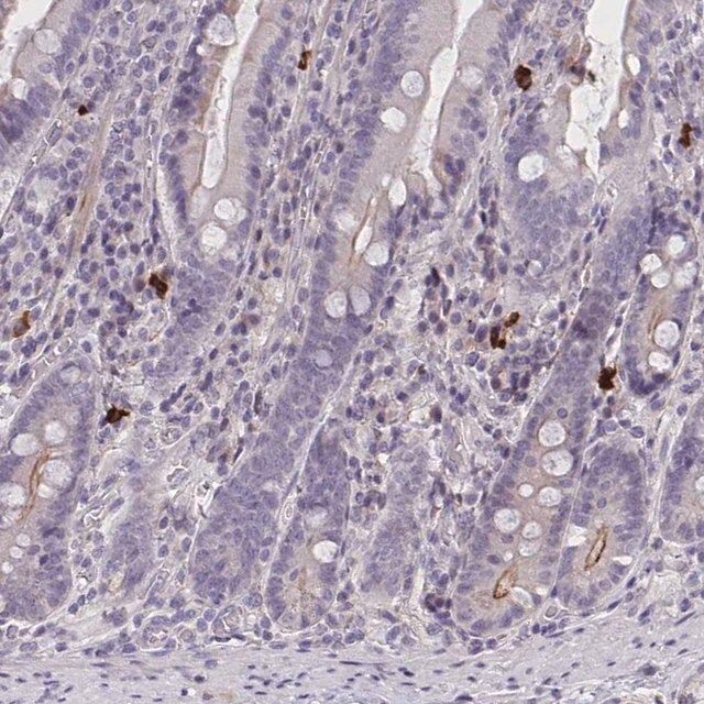 Anti-MRGPRX2 antibody produced in rabbit