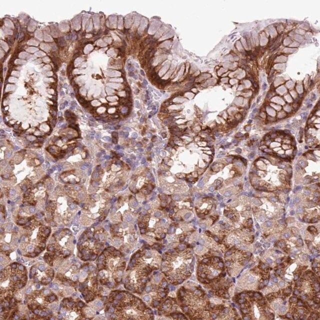 Anti-MROH2A antibody produced in rabbit