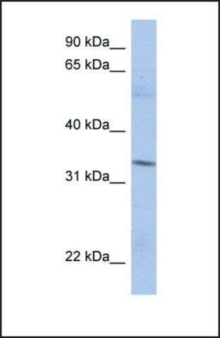 Anti-MRPL15, (N-terminal) antibody produced in rabbit