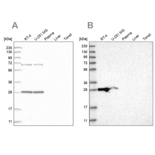 Anti-MRPL10 antibody produced in rabbit